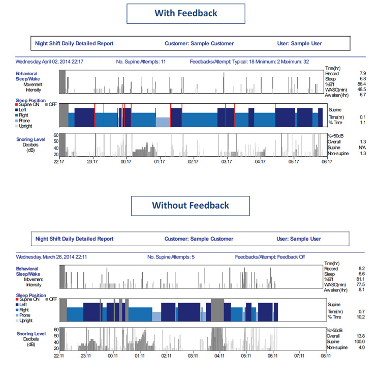 Detaillierter NightShift LE Schlafbericht zur Analyse von Schnarchlautstärke und Schlafpositionen von VIVISOL Heimbehandlungsgeräte Wien